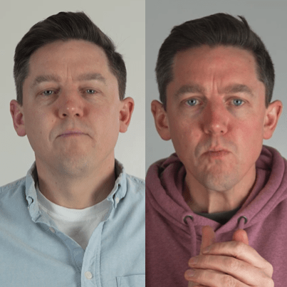 Side-by-side of Eoghan's health transformation